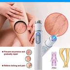 Varicose veins laser pen