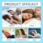Sleep Nasal Strips