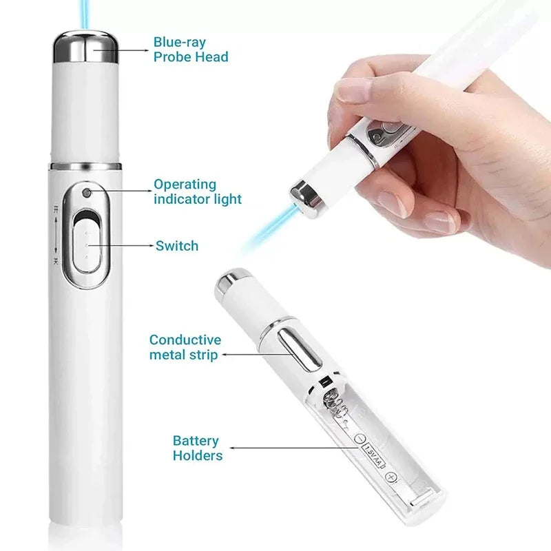 Varicose veins laser pen